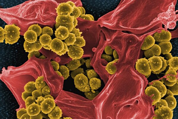 tumor-eating bacteria attacking cancer cells under microscope